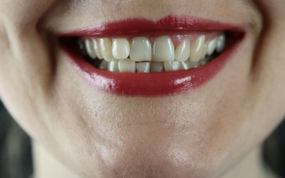 Consejos de Dentistas en Sevilla para una Buena Salud Oral y Dental