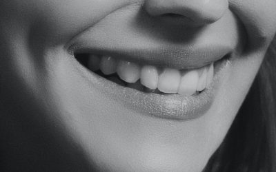 ¿Qué son las carillas dentales?