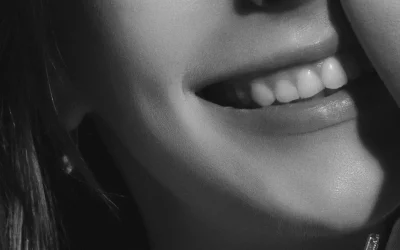 Carillas dentales para una sonrisa natural
