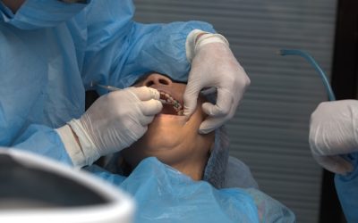 CBCT, higiene y estética: cómo la última tecnología transforma tu tratamiento dental